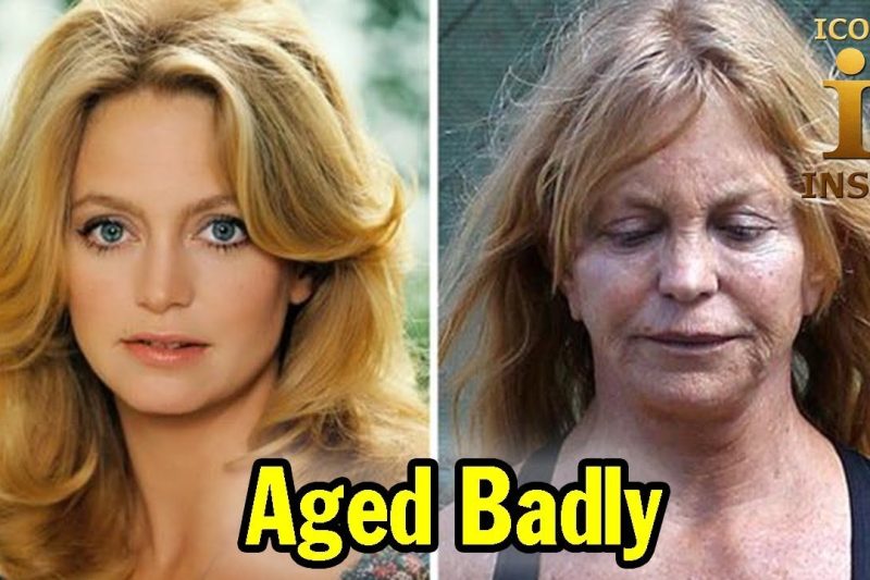 25 Celebrities Who Have Aged Badly