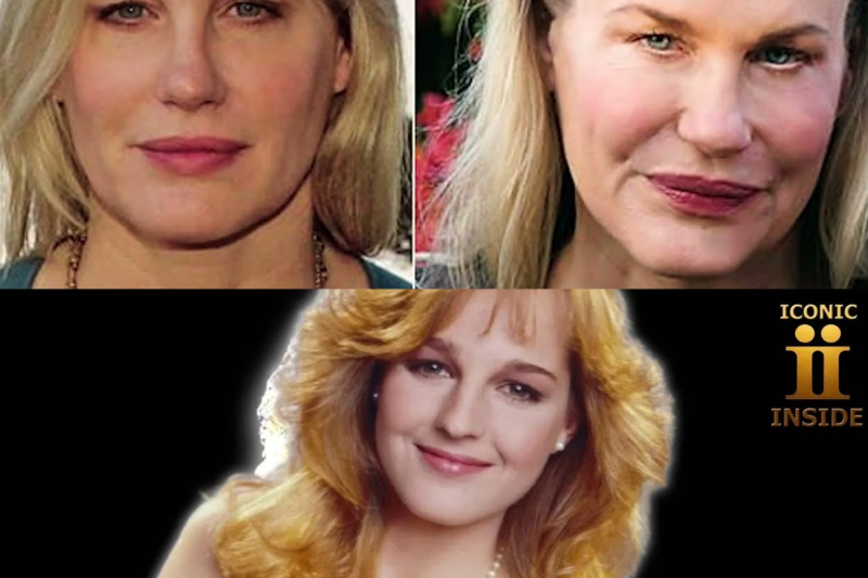 She Was Beautiful, NOW It’s Hard To Look At Her