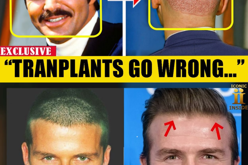 The Terrifying Price of Perfection: How Botched Hair Transplants Left Hollywood’s Biggest Icons with Permanent Scars and Deep Psychological Regret